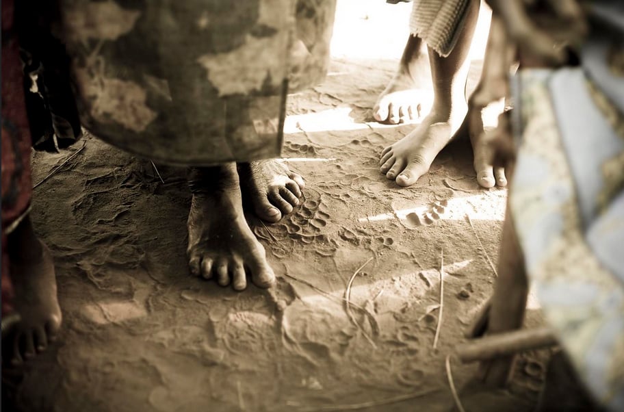 Mycetoma-Ethiopia-A-Tao